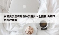 白癜风类型有哪些种类图片大全图解,白癜风的几种类型