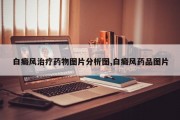白癜风治疗药物图片分析图,白癜风药品图片
