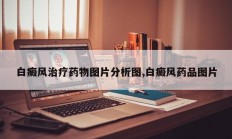 白癜风治疗药物图片分析图,白癜风药品图片