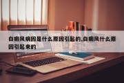 白癜风病因是什么原因引起的,白癜风什么原因引起来的