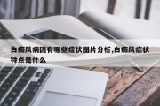 白癜风病因有哪些症状图片分析,白癜风症状特点是什么