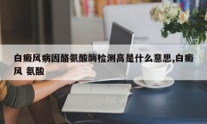 白癜风病因酪氨酸酶检测高是什么意思,白癜风 氨酸