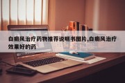 白癜风治疗药物推荐说明书图片,白癜风治疗效果好的药