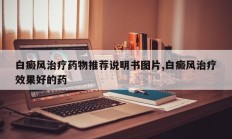 白癜风治疗药物推荐说明书图片,白癜风治疗效果好的药