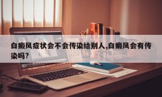 白癜风症状会不会传染给别人,白癜风会有传染吗?