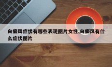 白癜风症状有哪些表现图片女性,白癜风有什么症状图片