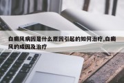 白癜风病因是什么原因引起的如何治疗,白癜风的成因及治疗
