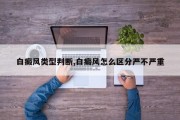 白癜风类型判断,白癜风怎么区分严不严重