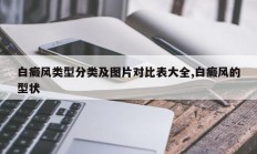 白癜风类型分类及图片对比表大全,白癜风的型状