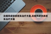 白癜风症状表现及治疗方案,白癜风症状表现及治疗方案