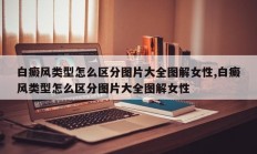 白癜风类型怎么区分图片大全图解女性,白癜风类型怎么区分图片大全图解女性