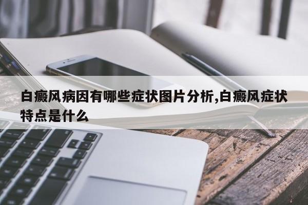 白癜风病因有哪些症状图片分析,白癜风症状特点是什么