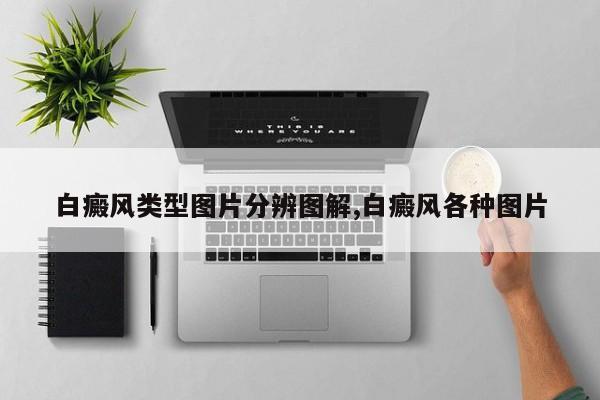 白癜风类型图片分辨图解,白癜风各种图片